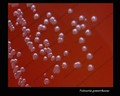 neisseria gonorrhoeae